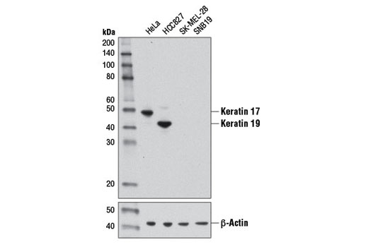 MTMR3 Antibody