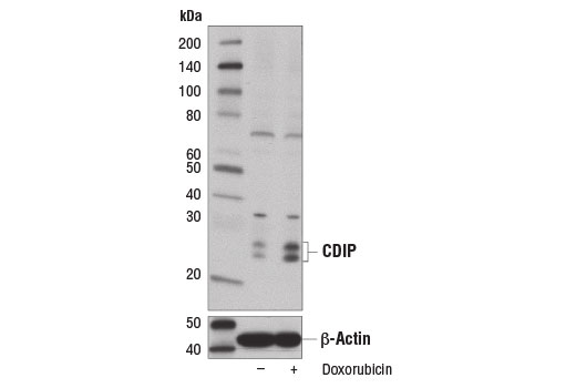 CDIP Antibody