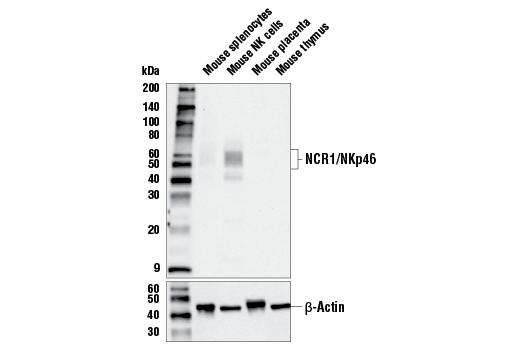NCR1/NKp46 (E2K4N) Rabbit mAb