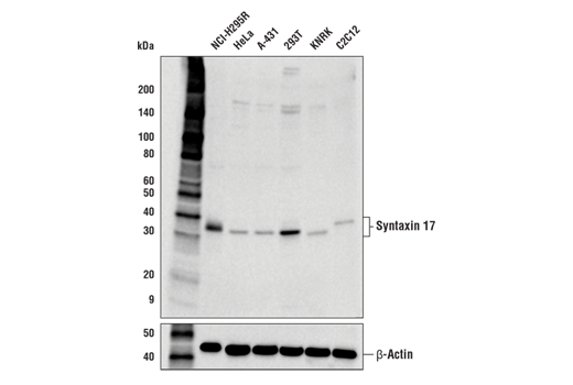 Syntaxin 17 (D3D7H) Rabbit mAb