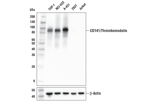 CD141/Thrombomodulin (E7Y9P) XPRabbit mAb