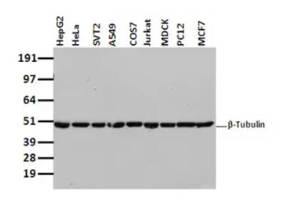Beta-Tubulin mouse monoclonal (5C1)
