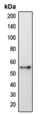 Anti-DFNA5/GSDME antibody