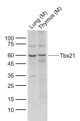 T细胞介导的转录调节因子Tbx21抗体