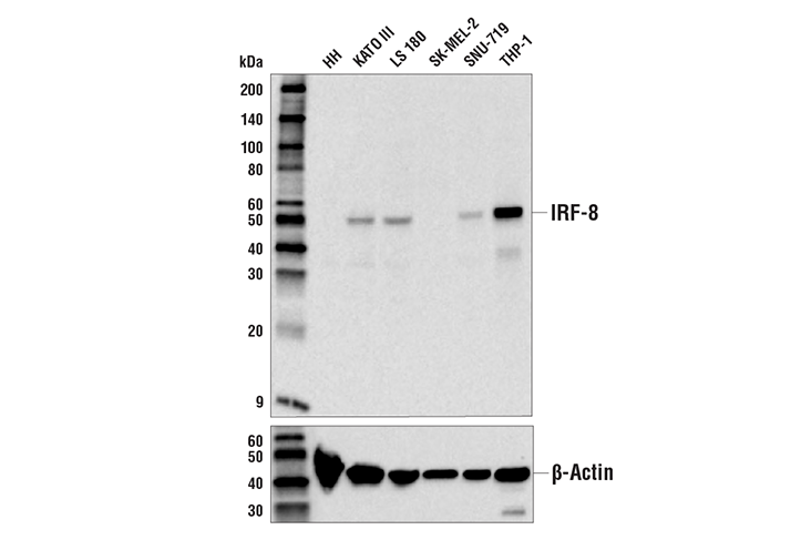 IRF-8 (E6J8Q) Rabbit Monoclonal Antibody