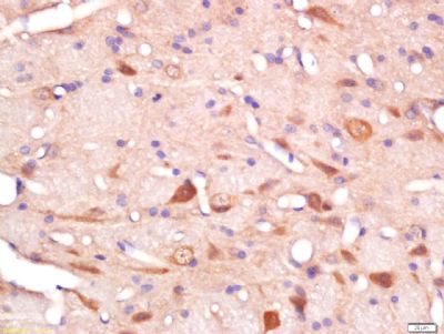 ras癌基因家族Rab11蛋白抗体