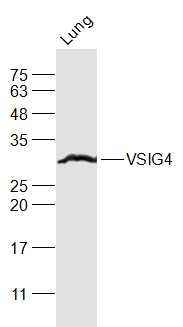 T淋巴细胞负调节蛋白抗体