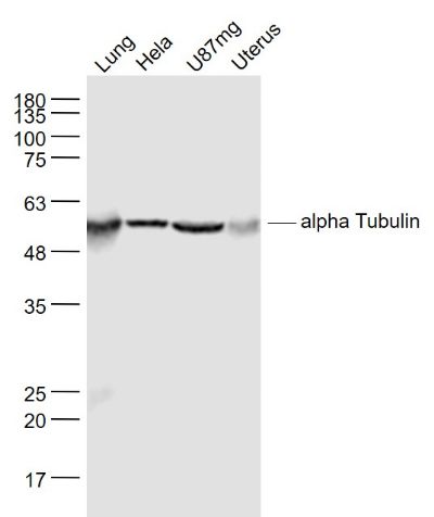 微管蛋白a/Tubulin a/a-tubulin单克隆抗体