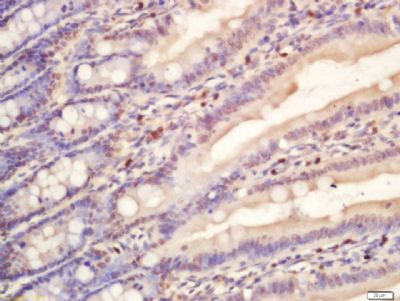 RNA聚合酶II抗体