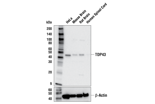 TDP43 (E2G6G) Rabbit mAb