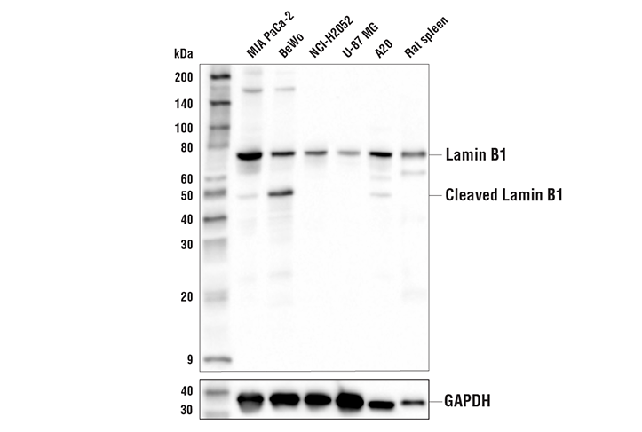 Lamin B1 (E6M5T) Rabbit mAb