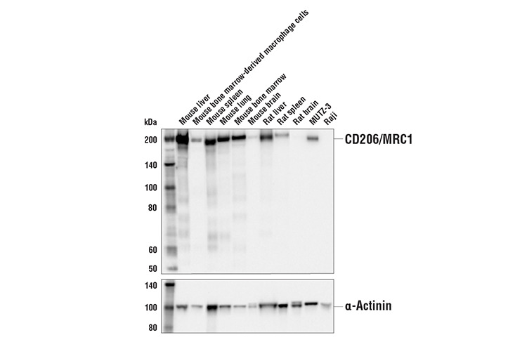 CD206/MRC1 (E6T5J) XP Rabbit mAb