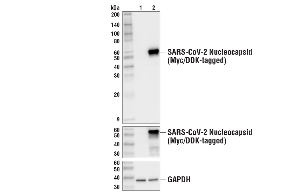 SARS-CoV-2 Nucleocapsid Protein (HL344) Rabbit mAb