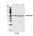 SQSTM1/p62 Antibody