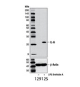 IL-6 (D5W4V) XP Rabbit mAb (Mouse Specific)