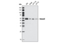 Wnt Signaling Antibody Sampler Kit