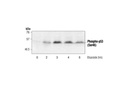 p53 Antibody Sampler Kit