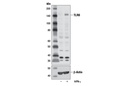 Toll-like Receptor Antibody Sampler Kit II