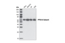 PP2A A Subunit (81G5) Rabbit mAb
