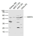 信号通路Wnt4抗体